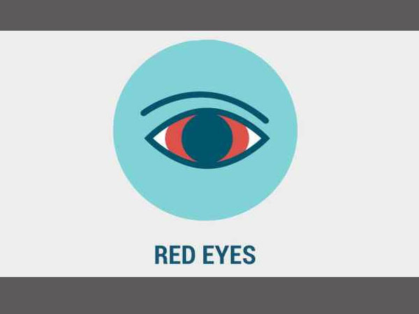 Zika fever: 6 symptoms of zika viral disease everyone should know!