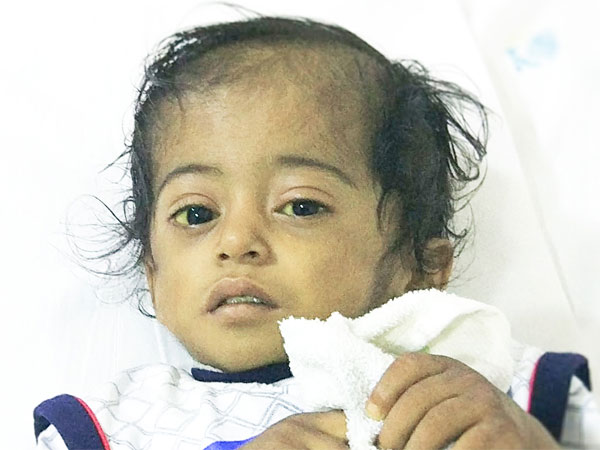 Ankur Cannot Afford His Son’s Heart Surgery on a Daily Wage Income