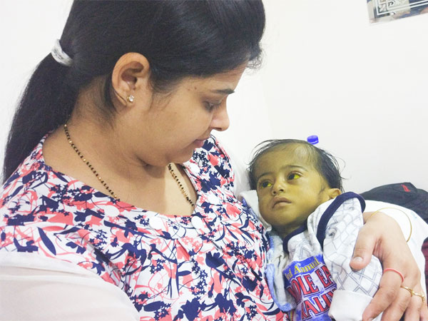 Ankur Cannot Afford His Son’s Heart Surgery on a Daily Wage Income