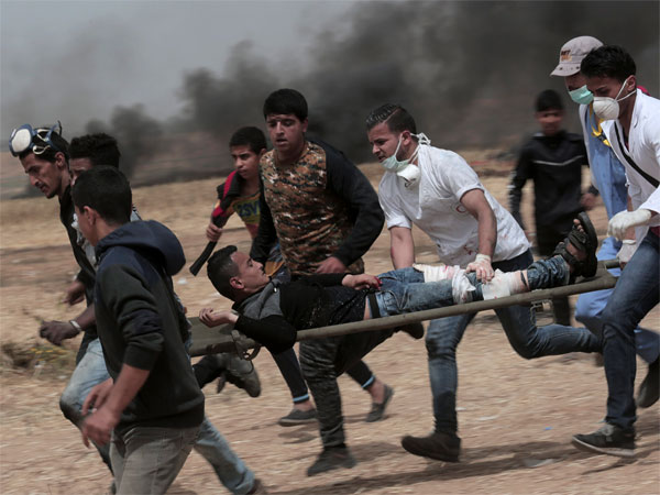 Over 1,100 Palestinians injured in Israeli firing, tear gas attack Over 1,100 Palestinians injured in Israeli firing, tear gas attack