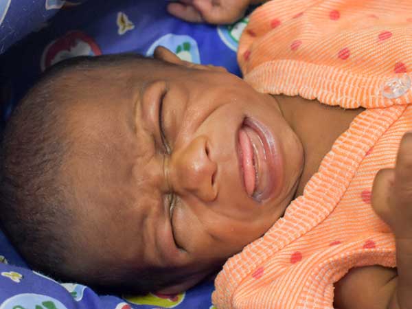 This Waiter’s 1-month-old Baby With A Congenital Heart Block Needs An Urgent Surgery to Survive