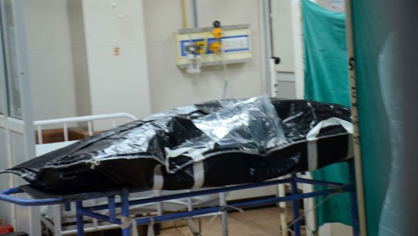 Vikas Dubey had three bullet injuries on the chest, one on his arm: