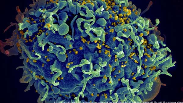 40 years of HIV/AIDS 40 years of HIV/AIDS