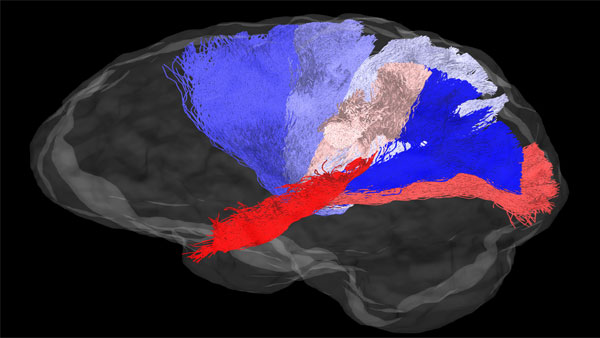 The image shows connections between the midbrain and various regions of the neocortex. Connections to each region are shown in a different colour, and were all estimated with diffusion MRI and tractography in the living human brain (Credits: Varsha Sreenivasan and Devarajan Sridharan)