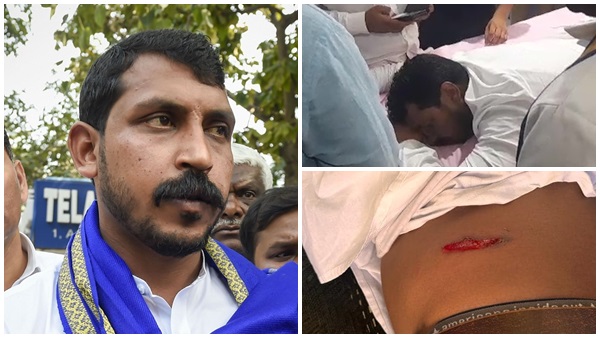 Bhim Army Chief Chandrashekhar Azad Ravan Shot At In UPs Saharanpur
