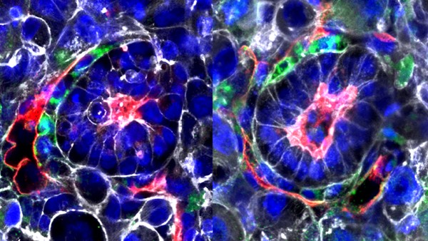 Baby Without Sperm Or Egg? Scientists Develop Synthetic Embryos Using Stem Cells