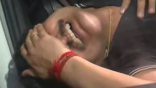 WATCH | DMKs Senthil Balaji Breaks Down Post ED Arrest; Taken to Hospital