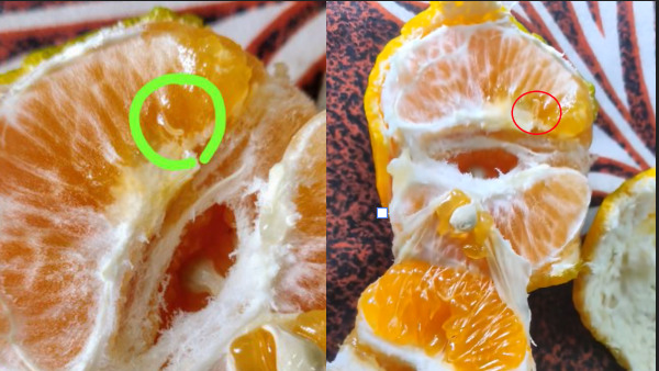 Viral Video Of Live Worm