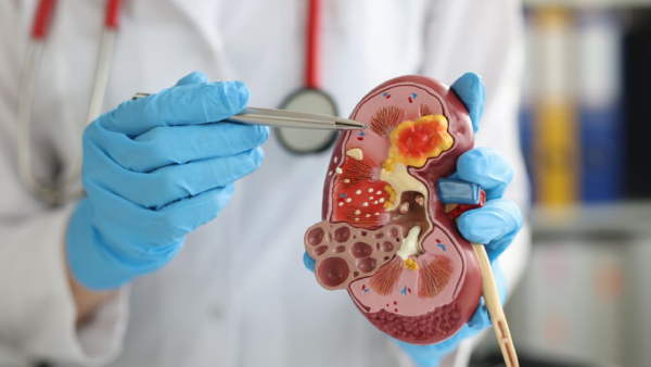 Top 5 Urology Hospital in Delhi