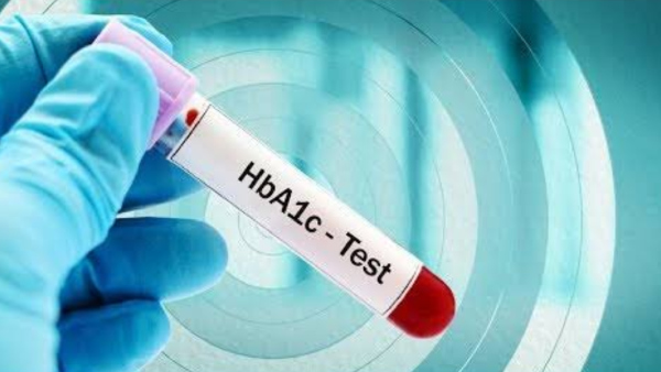 The Role of HbA1c Testing in Preventing Diabetes Complications The Role of HbA1c Testing in Preventing Diabetes Complications