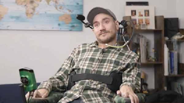 Neuralink s Brain Implant Trials