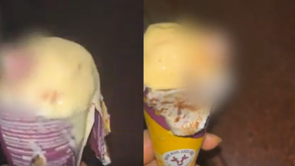 Mumbai Doctor Finds Human Finger In Online-Ordered Ice Cream I Thought Tt Was A Big Nut