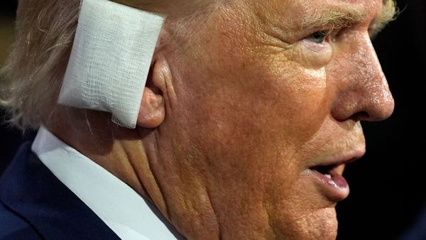 Trump Makes First Public Appearance Since Rally Shooting Sporting Bandaged Ear