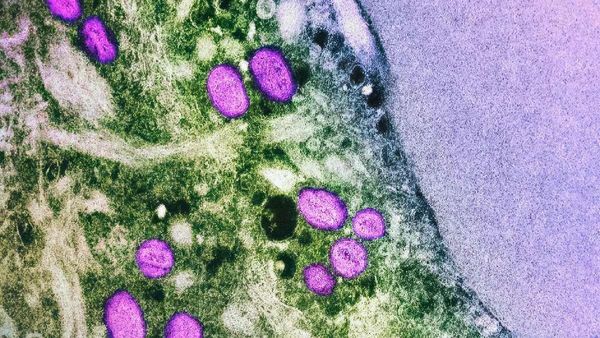 How Did The Mpox Outbreak Boost Bavarian Nordic s Profits