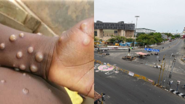 Monkeypox Lockdown Will There Be Another Lockdown Imposed Again Due To Mpox
