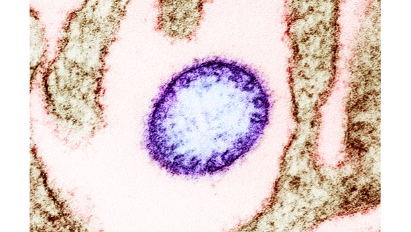 Nipah Virus