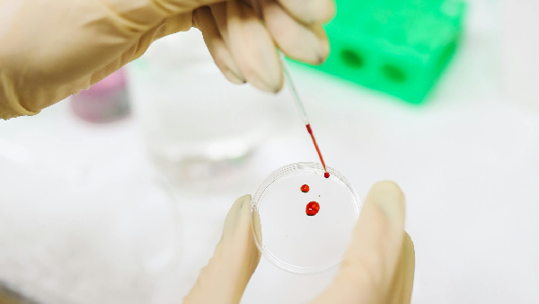 Lab Test Charges To Be Regulated Lab Test Charges To Be Regulated