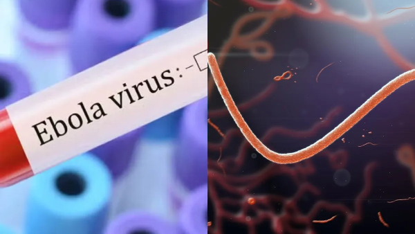 Bengaluru Woman Suspected Of Ebola Infection Tests Negative No Confirmed Case In India Amid Africa Outbreak