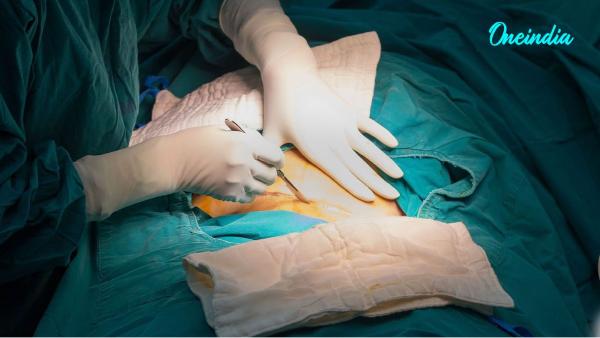 C-Sections C-Sections