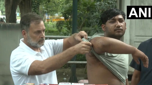 Congress MP Rahul Gandhi with pellet gun victim student Sahil