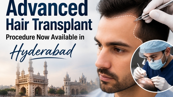 Sapphire FUE The Hair Transplant Revolution You Need