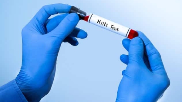 H1N1 H1N1