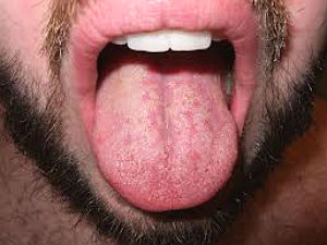 up-attempt-to-molest-teenager-bites-off-tongue-of-youth up-attempt-to-molest-teenager-bites-off-tongue-of-youth
