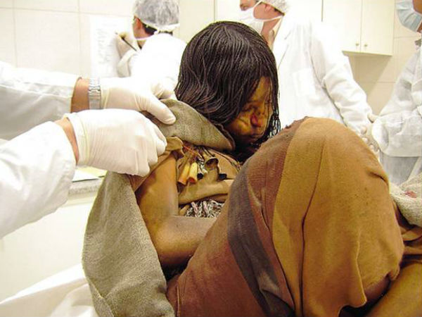 ಎಂಥ ಸೋಂಕಿನಿಂದ ಬಳಲುತ್ತಿದ್ದಳು?