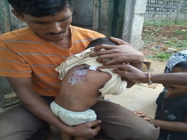 A women and child was attacked by Pig in Srirangapatna, Mandya A women and child was attacked by Pig in Srirangapatna, Mandya