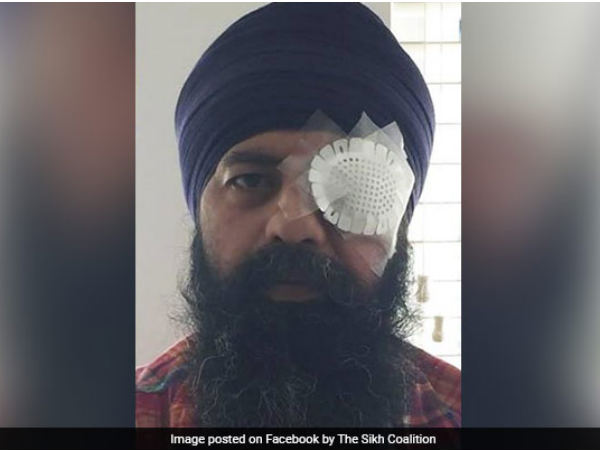Racial attack in US: Sikh techie faces brutal assault, civil rights group demands justice Racial attack in US: Sikh techie faces brutal assault, civil rights group demands justice