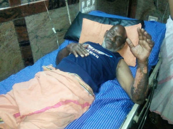 Petrol attack on couple, Man sustains burn injuries