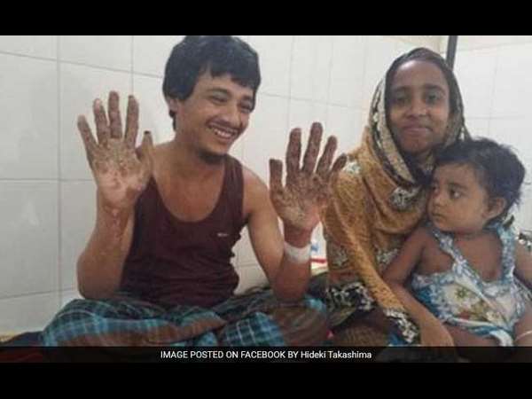 Bangladesh 'Tree Man' recovered after 16 Surgeries