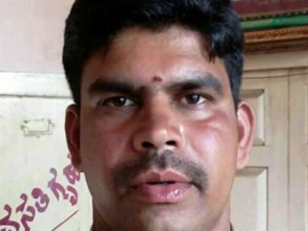 A police constable in Begur taluk, chamarajnagar district commits suicide.