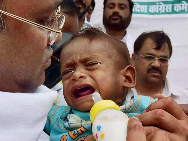 ಮಕ್ಕಳ ಬೆಳವಣಿಗೆ ಕುಂಠಿತ