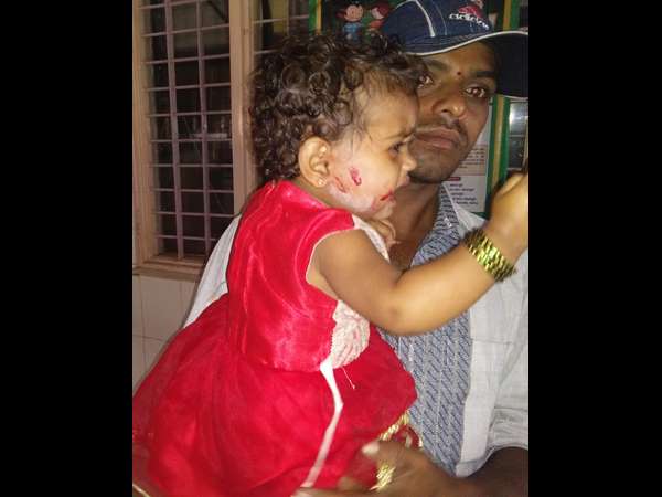 Stray dog bitಎs 3 kids in Yalandur, Chamarajanagar