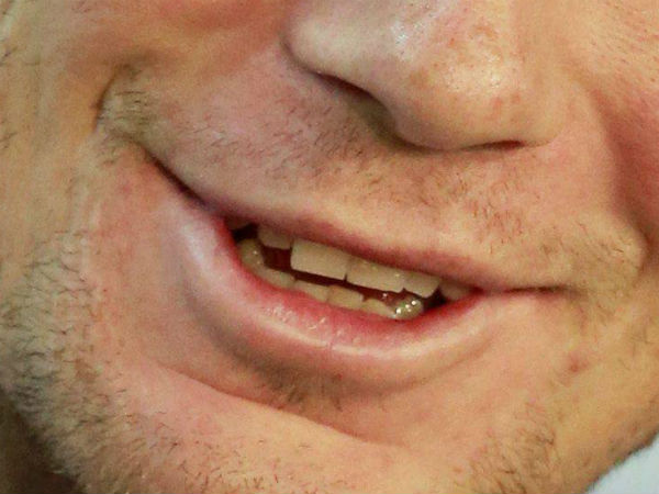 ಸೋಗಿನ ನಗು 