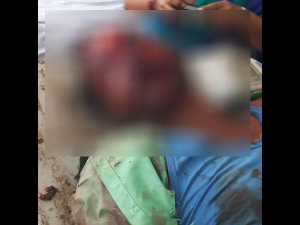 Road accident : No one helps for bike rider 