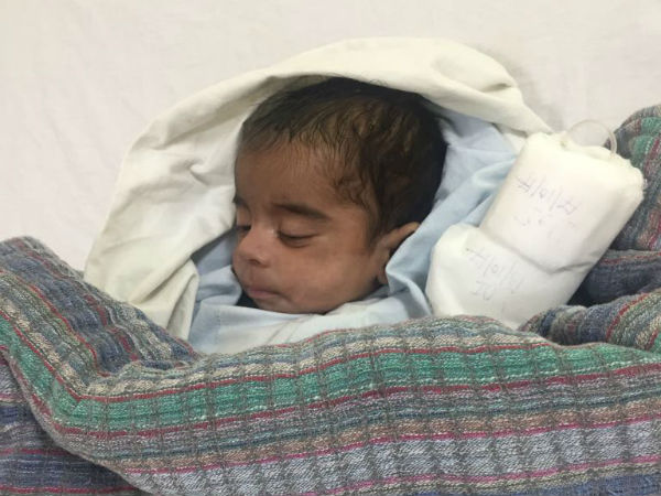 Please help us to save our two and half month child