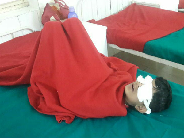 Tragic Deepavali: Total 40 people injured by firecrackers in Karnataka Tragic Deepavali: Total 40 people injured by firecrackers in Karnataka