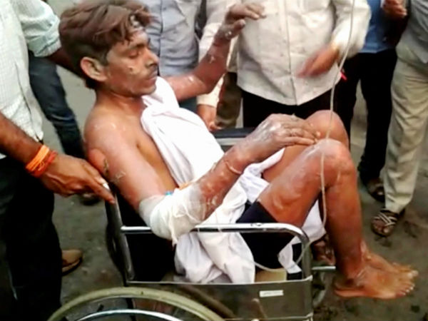 ನೂರಾರು ಮಂದಿ ಕಾರ್ಮಿಕರು, ಅಧಿಕಾರಿಗಳು ಗಾಯಾಳು ನೂರಾರು ಮಂದಿ ಕಾರ್ಮಿಕರು, ಅಧಿಕಾರಿಗಳು ಗಾಯಾಳು