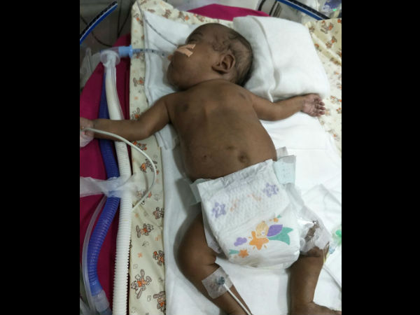 Please help this couple to save the child
