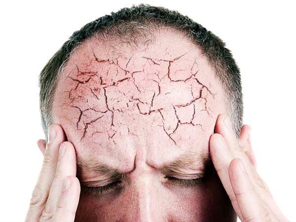 ಕೆಟ್ಟ ನೆನಪು ಸರಿದುಹೋಗಲಿ ಹಾಗೇ...