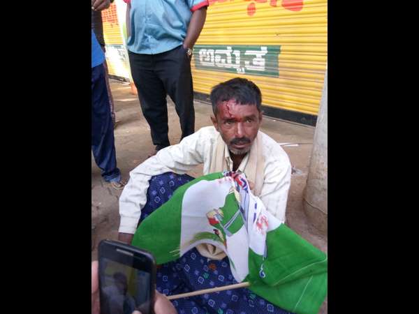 Lathi charge in Chickaballapur, some protesters injured
