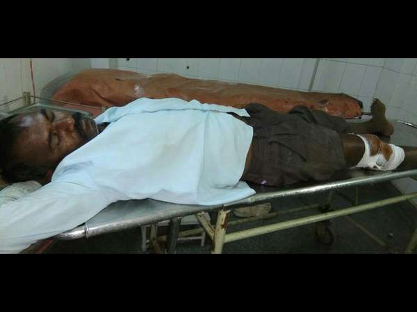 Police fires on a goon in Kalaburagi Police fires on a goon in Kalaburagi