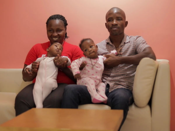 Conjoined twins from Nigeria successfully separated at Narayana Health City Conjoined twins from Nigeria successfully separated at Narayana Health City