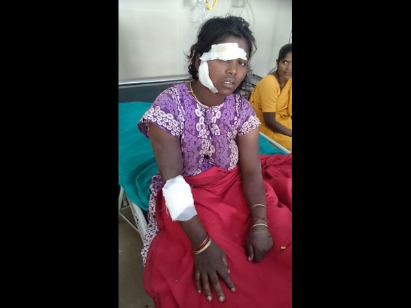 Bear attack claims four months child near Bhadravati