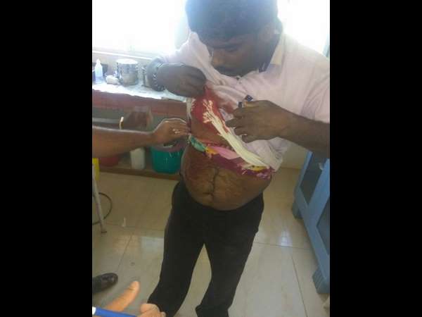 Huge clash between villagers for water in Devanahalli taluk