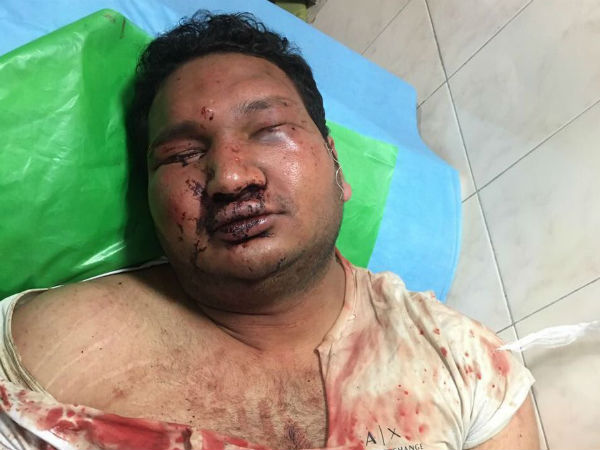 ನಲಪಾಡ್ ನಡೆಸಿದ ಹಲ್ಲೆ ತೀವ್ರ ಕಲಕಿದೆ