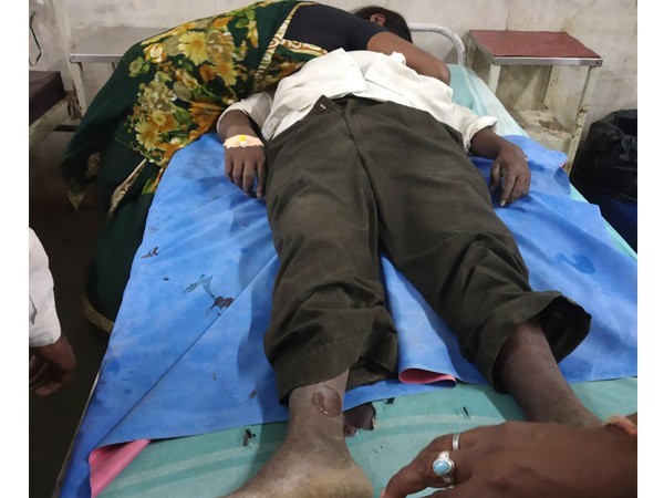 ರೈತರ ಆತ್ಮಹತ್ಯೆ ವಿಚಾರದಲ್ಲಿ ನೀವೇನು ಮಾಡುವಿರಿ