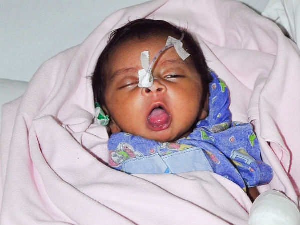 Daughter of a daily wage worker needs an urgent heart surgery